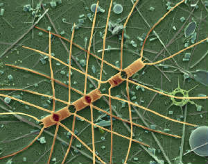 Micrograph of a micro-plankton - Observe skeletal remains of Diatoms.