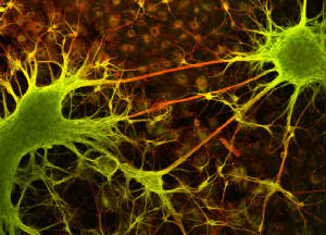 human NT 2 Neuronal cells 6 weeks old