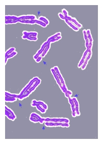 Broken chromosomes