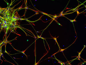 Dna Research / neural stem cells