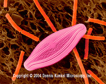 Diatom and rodbacterias