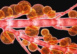 microbes - algae and diatoms -10x