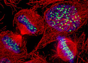 Mitotic human cells microtubules kinetochores and DNA