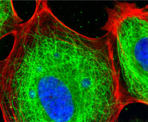 Nano World big cytoskeleton cover