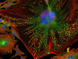Trabecular with DNA stained in Blue.