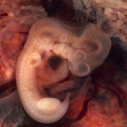 Human embryo 35 days