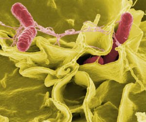 Salmonella can Kill you