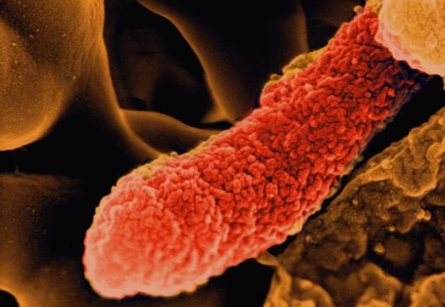Pseudomonas aeruginos